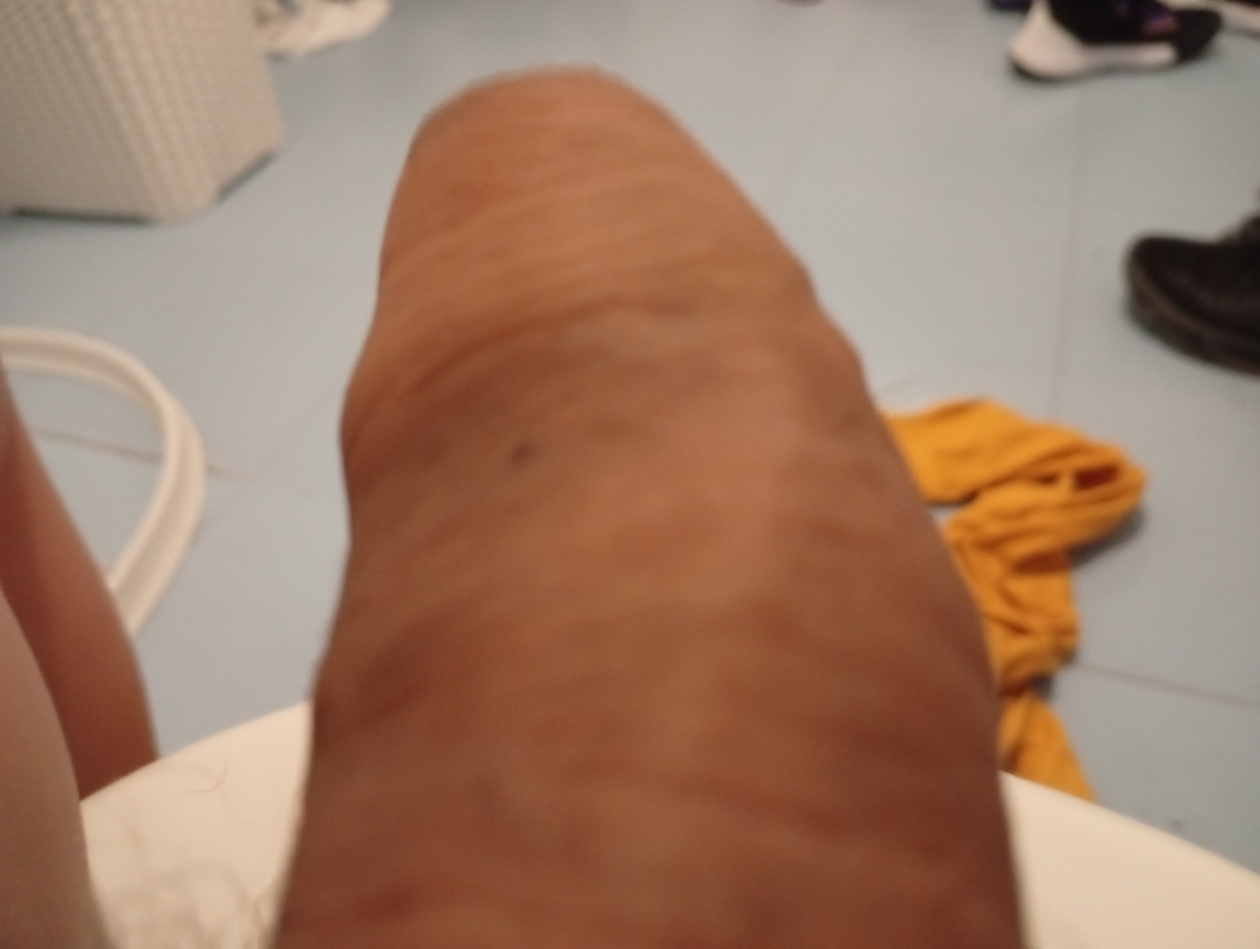 1000003594.jpg